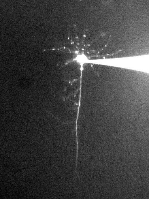 Svart-hvitt-foto av fluorescerende celle